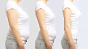 Weight Loss Injections